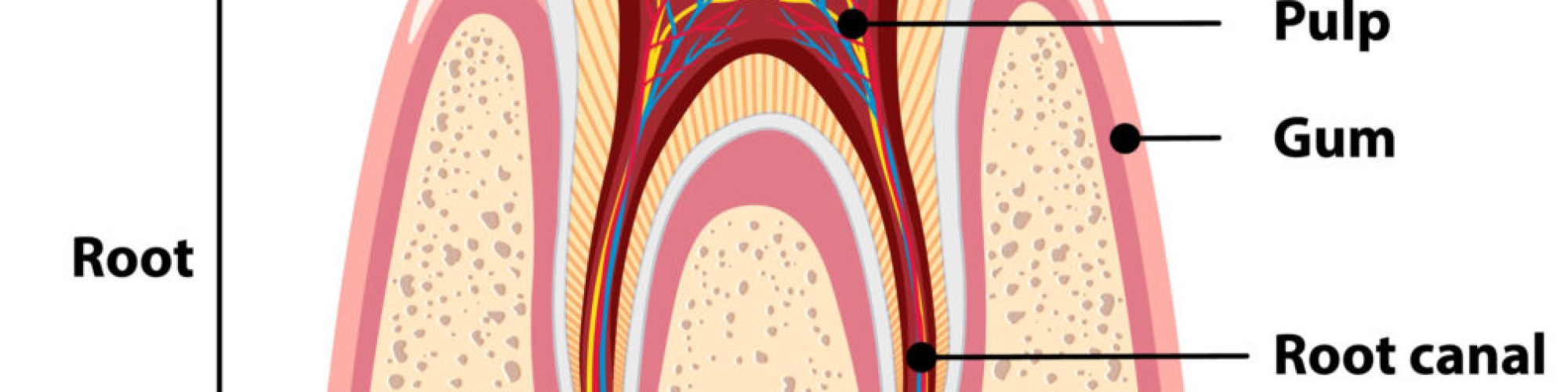 root canal bukit timah